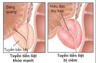 Không có ảnh