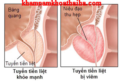 Không có ảnh